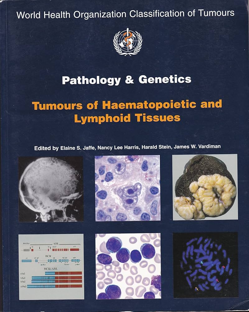 Amazon | WHO Classification Tumours of Haemopoietic and